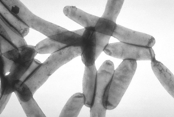 Legionella Bacteria