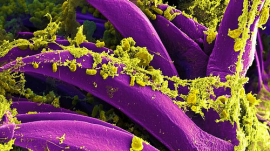 Bubonic Plague bacteria