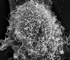 Ebola Virus Particle